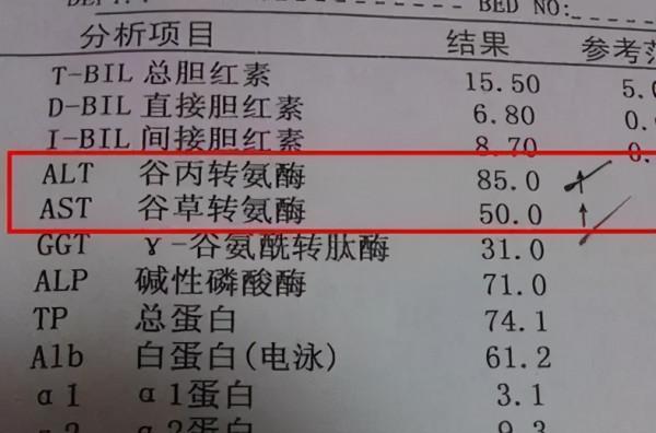 肝功能檢查單拿在手裡怎麼看？醫生：3個指標，看懂不用找醫生