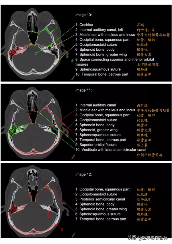 CT斷層解剖圖譜最全總結「推薦收藏」 CT斷層解剖圖譜最全總結「推薦收藏」