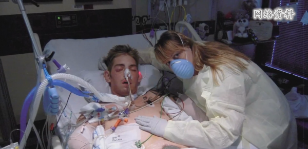 不得不承認美國醫術很強:斷了6年的雙臂,竟成功移植他人手臂 不得不承認美國醫術很強:斷了6年的雙臂,竟成功移植他人手臂