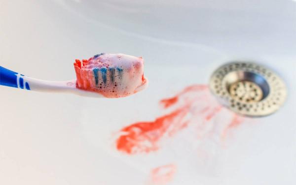 牙齒出血可能不只是牙的問題,重視健康警報,出現3種情況別大意 牙齒出血可能不只是牙的問題,重視健康警報,出現3種情況別大意