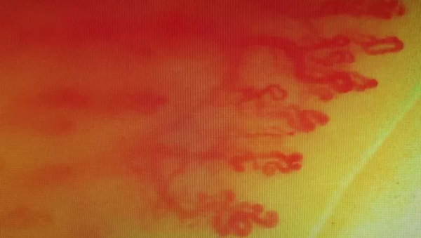 天氣轉涼,保護好我們的“第二心臟”!面板乾裂、手腳冰涼,血壓升高都與之相關 天氣轉涼,保護好我們的“第二心臟”!面板乾裂、手腳冰涼,血壓升高都與之相關