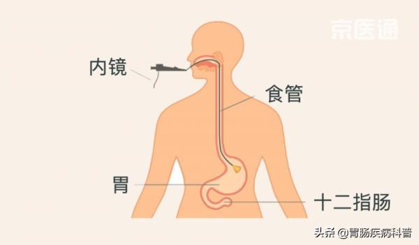 3分鐘看懂——胃鏡報告 3分鐘看懂——胃鏡報告