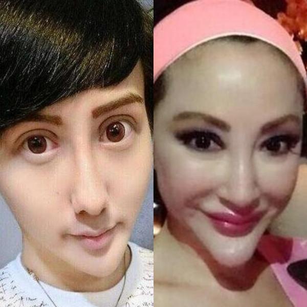 娛樂圈這8位女星被整容毀掉，有人臉僵如石，有的“堪比換頭”