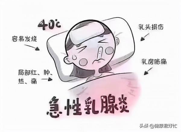 急性乳腺炎的中西醫辯證及調理方法