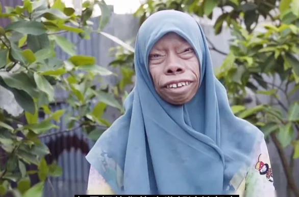 男子一家人患怪病，長得像動物，至今沒有治療方法