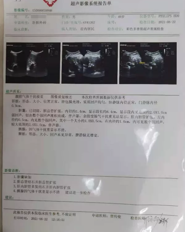 他19年前切了膽，到了今天只有一個想法：請把我的膽還給我