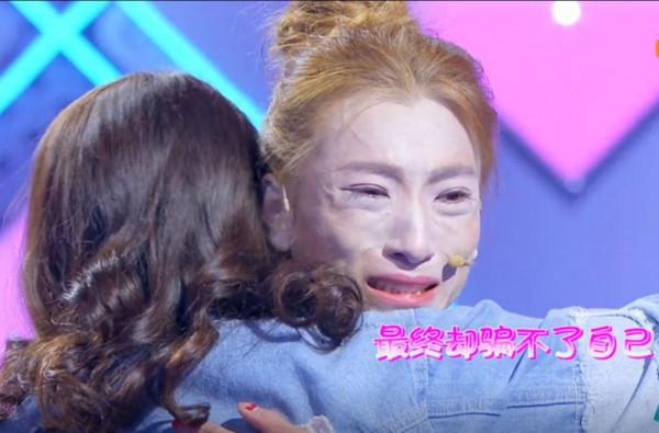 “骷髏妹”劉野：為愛痴狂，從120斤瘦到58斤，男友卻不敢見她