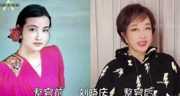 10位“整容過度”的女星：舒暢張檬畫蛇添足，黃夏惠變“鞋拔臉”