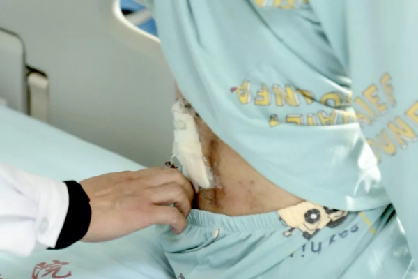 「健康資訊」擼串意外感染“怪病”?我emo了 「健康資訊」擼串意外感染“怪病”?我emo了