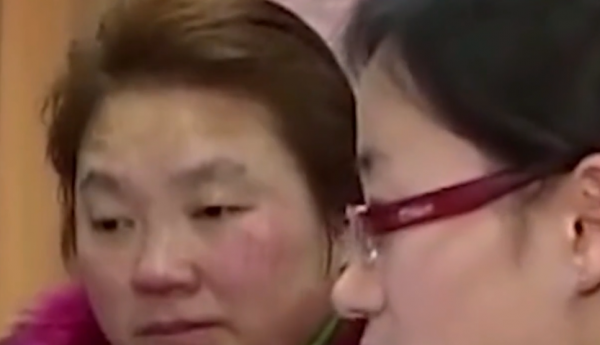 真實故事：湖南40歲婦女患怪病，一覺能睡2個月，專家查出真相