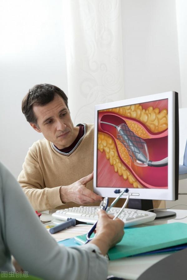 放支架是長壽還是短壽?心血管專家:和支架關係不大,要看3點 放支架是長壽還是短壽?心血管專家:和支架關係不大,要看3點