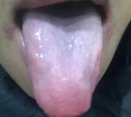 痰多二陳丸沒用，佐脾丸強力化痰，化痰消滯、理氣健脾、橫掃痰溼