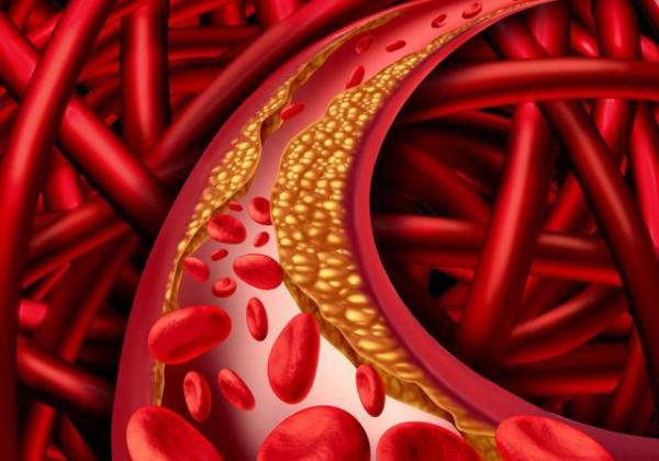 春節前後，或是心血管疾病高發期，建議中老年人做好這幾點