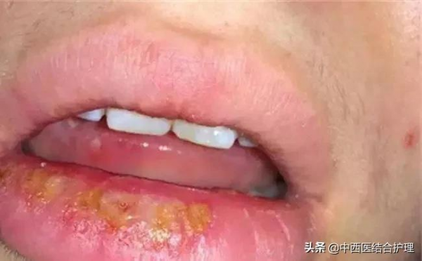 「中醫養生」上火下寒體質，原來是這裡堵住了