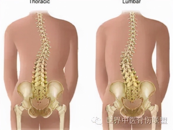 青少年預防頸椎病的四個要點