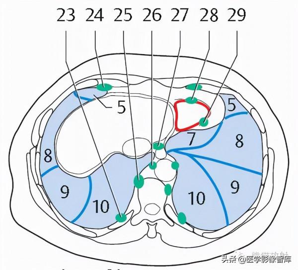 CT斷層解剖圖譜最全總結「推薦收藏」 CT斷層解剖圖譜最全總結「推薦收藏」