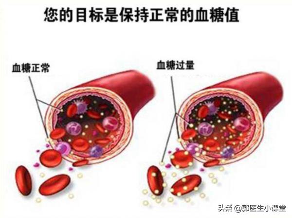 廣東29歲女生喝奶茶進ICU,糖尿病離年輕人究竟有多近? 廣東29歲女生喝奶茶進ICU,糖尿病離年輕人究竟有多近?