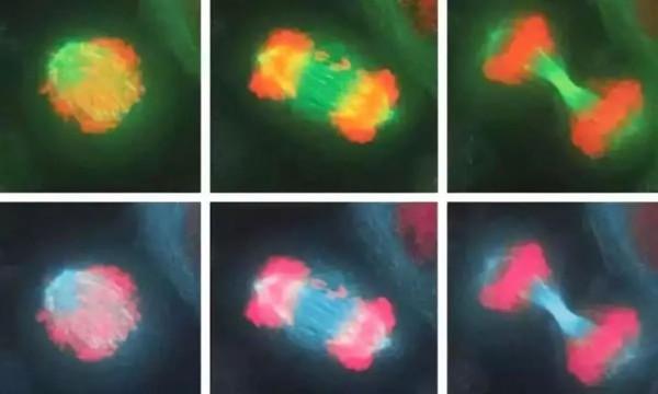 永生的海拉：擁有不死細胞的女人，繁衍細胞質量等同10座帝國大廈