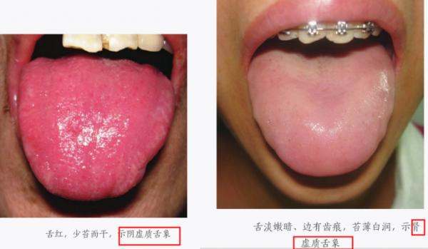 九種常見體質,你是哪一種? 九種常見體質,你是哪一種?