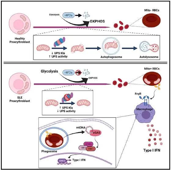 ​紅細胞中“捨不得”丟掉的線粒體可引發系統性紅斑狼瘡的炎症 ​紅細胞中“捨不得”丟掉的線粒體可引發系統性紅斑狼瘡的炎症