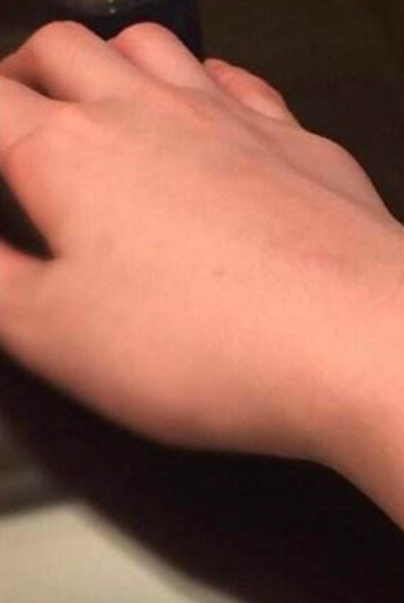 劉亦菲自曝患頸椎病十幾年！傷勢嚴重帶脖套工作，片場拍戲不怕疼