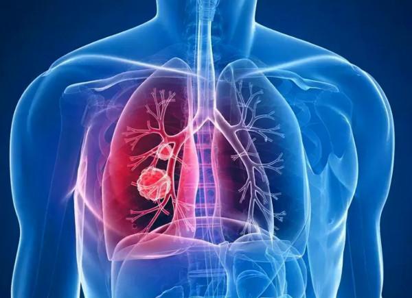 中醫理論深度解析肺部疾病