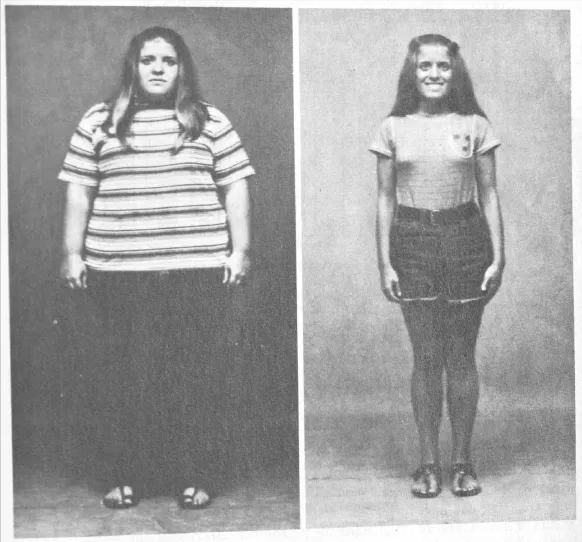 只吃大米和白糖，瘦了100多斤？關於&OpenCurlyDoubleQuote;碳化症&rdquo;的一些思考