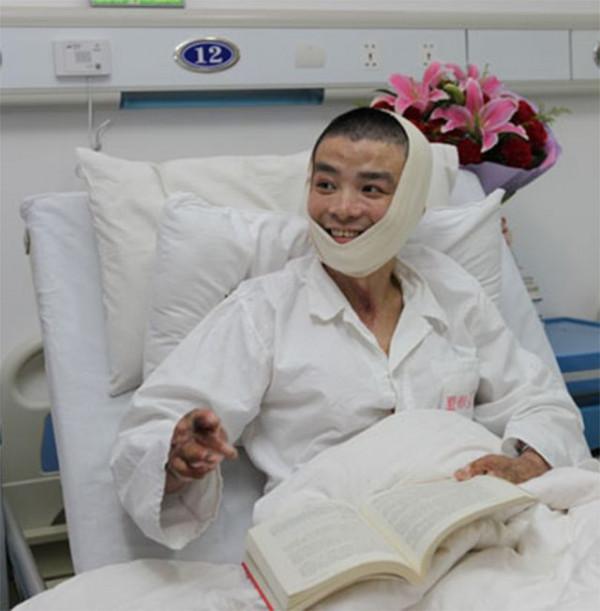 11年前,那個探親中途浴火救44人,全身90%燒傷的子弟兵,現況如何