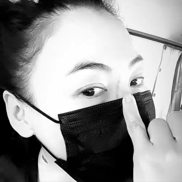 張柏芝被3歲小兒子抓傷臉部，傷口較長且深像刀疤一樣遮都遮不住