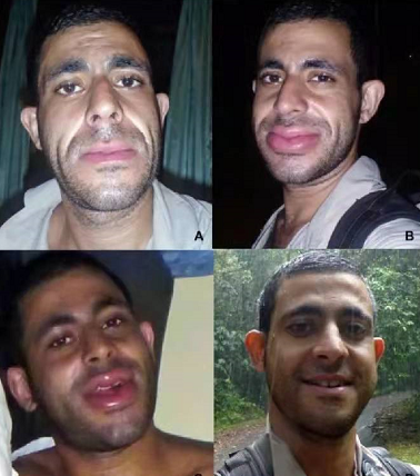 這猴子可愛的外表下，竟是一口毒牙，還會模仿眼鏡蛇...