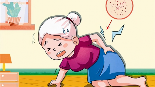 哪些人更容易患骨質疏鬆？&OpenCurlyDoubleQuote;1個公式&plus;1個測試&rdquo;教你自測骨質疏鬆