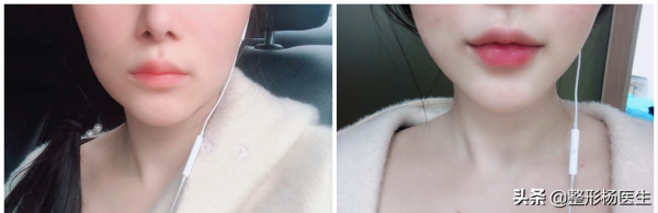 為什麼anglababy的微笑唇這麼受歡迎!我來告訴你答案 為什麼anglababy的微笑唇這麼受歡迎!我來告訴你答案