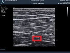 肩頸背腰疼痛久治不愈？一起了解下無菌性炎症