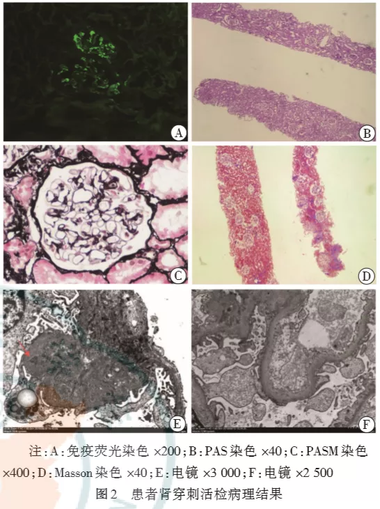 泡沫尿、腳腫、尿蛋白3+，腎科醫生最怕你用的一類“護膚品”