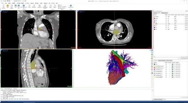 大學生如何選購膝上型電腦？（各大專業電腦推薦）