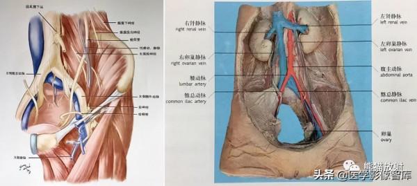 CT斷層解剖圖譜最全總結「推薦收藏」 CT斷層解剖圖譜最全總結「推薦收藏」