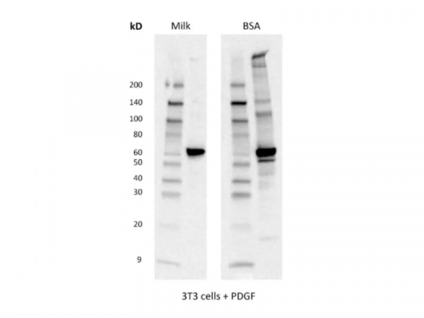 嗅嗅網丨Western blot：從實驗小白進階到高手的秘籍