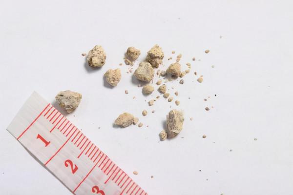 素食者比肉食者多活4年?吃素和吃肉,究竟以哪個為食更健康? 素食者比肉食者多活4年?吃素和吃肉,究竟以哪個為食更健康?