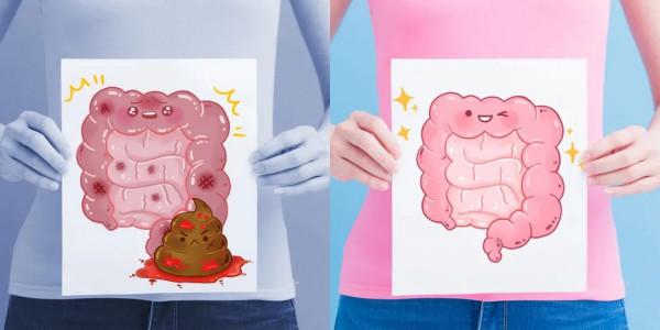 最容易被忽視的大腸癌篩查