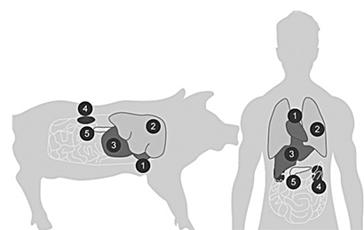 人類首例!豬腎移植人體手術完成,幾天內沒有排異反應發生 人類首例!豬腎移植人體手術完成,幾天內沒有排異反應發生