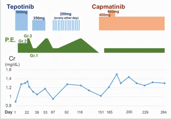 卡馬替尼成功克服了Tepotinib引起的無法耐受的外周水腫 卡馬替尼成功克服了Tepotinib引起的無法耐受的外周水腫