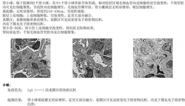 哈醫大一院群力院區成功開展兒童全麻下腎臟穿刺活檢術