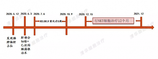 90後男生結腸癌肝轉移，除了化療，還有一種新方法