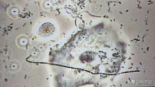 細胞因子風暴：你的免疫系統，才是真正的奪命“殺手”
