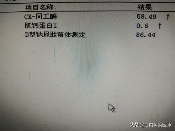 突發心梗，急救藥選哪種？