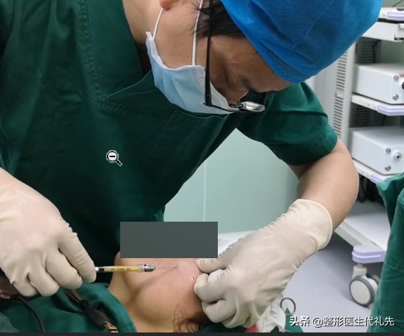 微創小切口面部提升+面部脂肪,朋友說術後看著能年輕上至少10歲 微創小切口面部提升+面部脂肪,朋友說術後看著能年輕上至少10歲