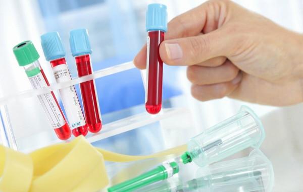 吃降壓藥治療高血壓,出現乏力、疲倦還有噁心,可能是缺鉀了 吃降壓藥治療高血壓,出現乏力、疲倦還有噁心,可能是缺鉀了