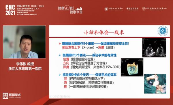 中國瓣膜病介入治療技術和研究盛況空前!CHC2021結構性心臟病論壇報道 中國瓣膜病介入治療技術和研究盛況空前!CHC2021結構性心臟病論壇報道