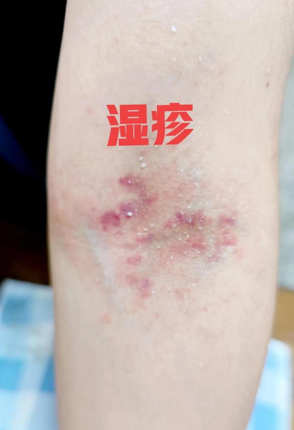 4種常見的面板病,教你最實用的識別和處理方法 4種常見的面板病,教你最實用的識別和處理方法