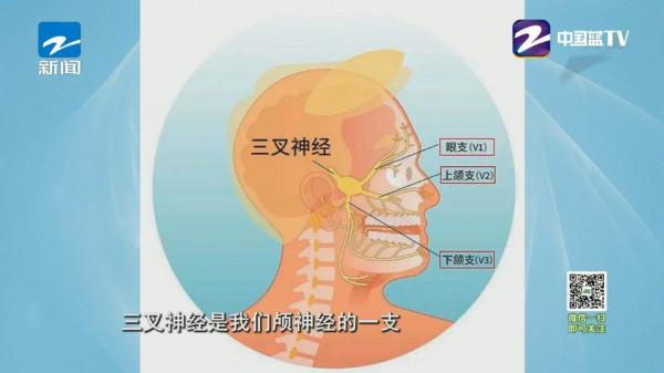 這種病痛起來生不如死！還有可能導致抑鬱，我們該如何預防？